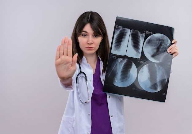 Рентгенография: первичный метод обнаружения воспаления легких