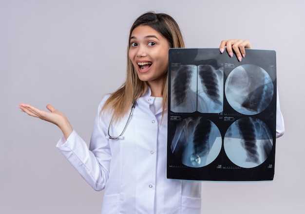 Компьютерная томография (КТ): точное определение характеристик пневмонии