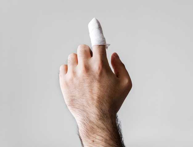 Нарыв заусенца на пальце: причины и симптомы